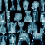 Radiologia Diagnostica per immagini e interventistica