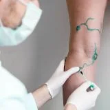 Chirurgia Vascolare
