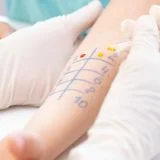 Allergologia e Malattie rare