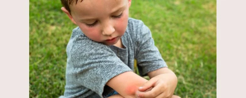 Cos'è l'impetigine in adulti e bambini e come curarsi