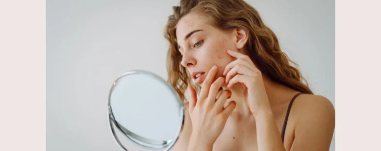 Laser CO2 frazionato per cicatrici da acne: quando la tecnologia migliora la pelle