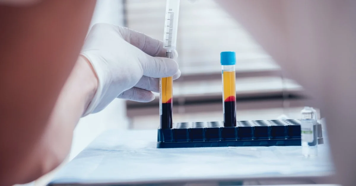 Cosa sono le transaminasi e come leggere i valori