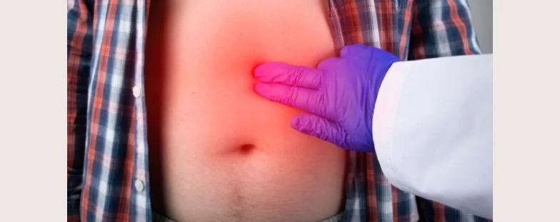 Ernia o laparocele: quali sono le differenze? 