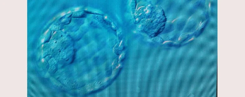 Cosa sono le blastocisti e come funziona il trasferimento