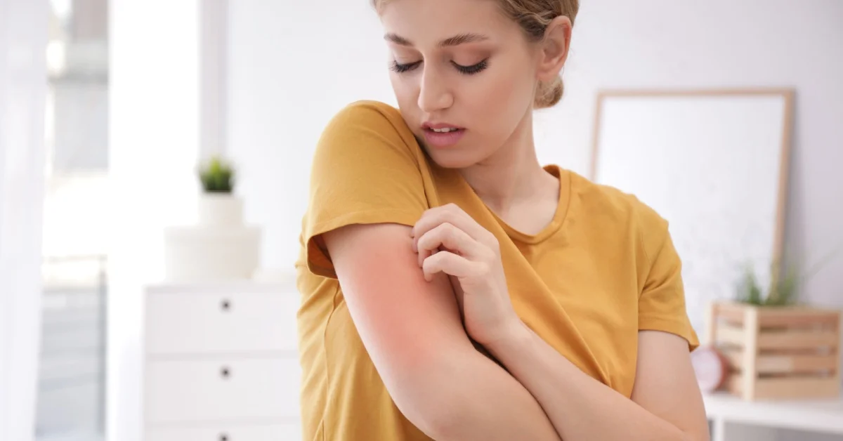 Prurito: cause, rimedi e quando preoccuparsi