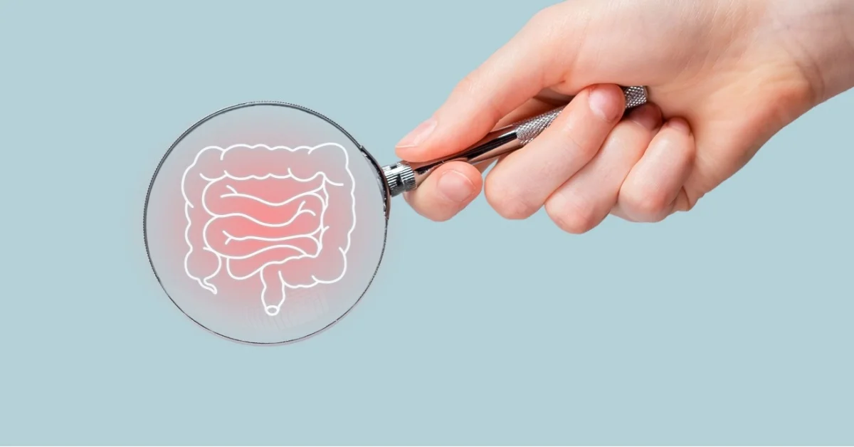 Tumore del colon-retto: come riconoscerlo e come si cura 