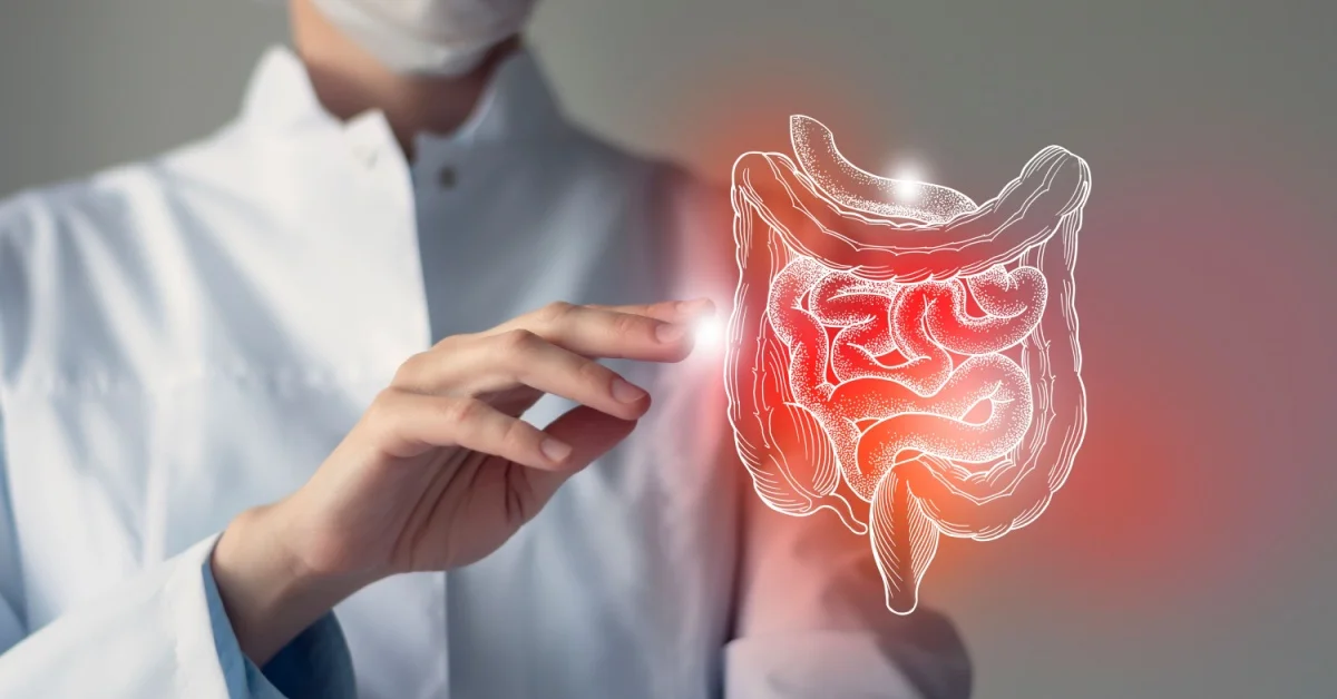 Colite ulcerosa: uno studio clinico multicentrico del San Raffaele apre nuove prospettive al trattamento con un innovativo anticorpo monoclonale
