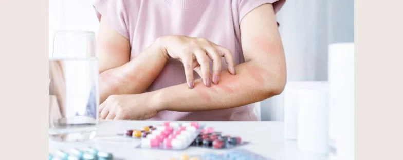 Come sapere se si è allergici ai farmaci?