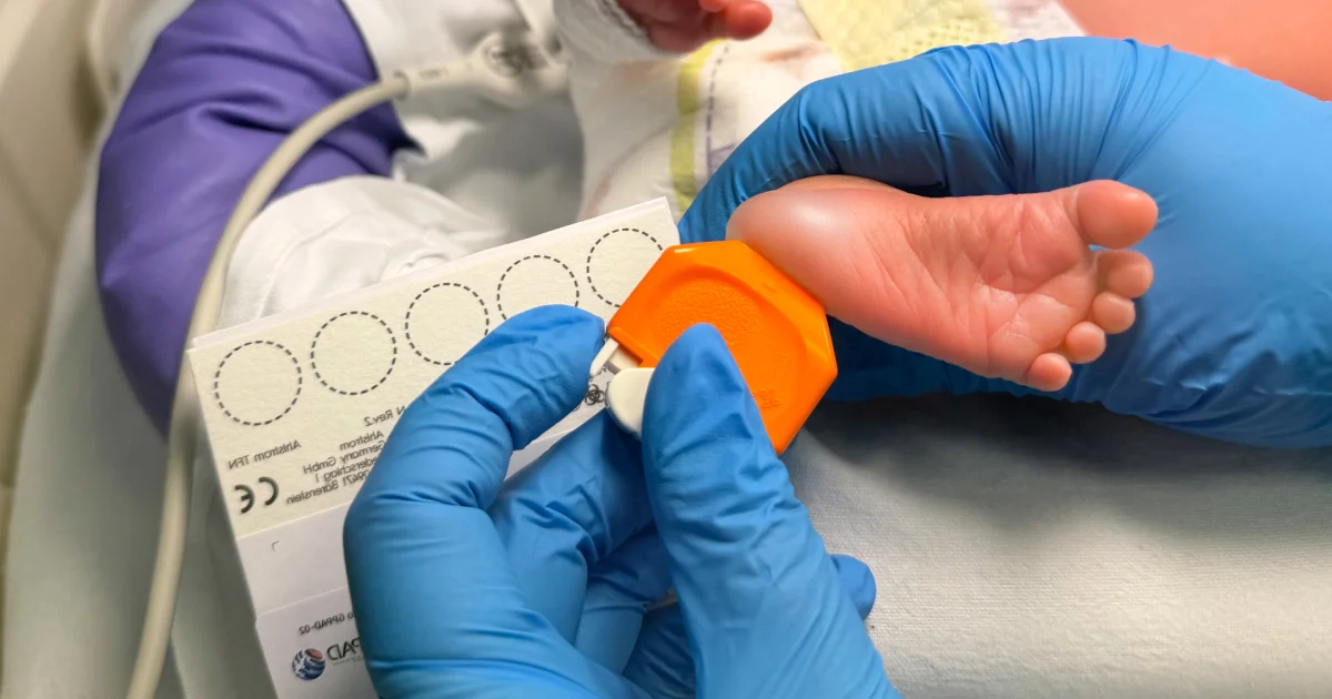 Al San Raffaele il primo programma italiano di screening genetico neonatale per la prevenzione primaria del diabete di tipo 1