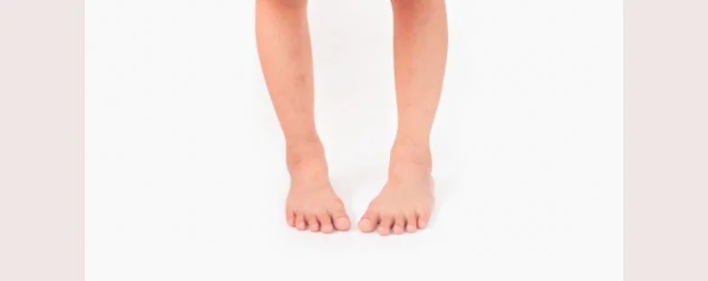 Camminata con i piedi all’interno: quando preoccuparsi e cosa fare