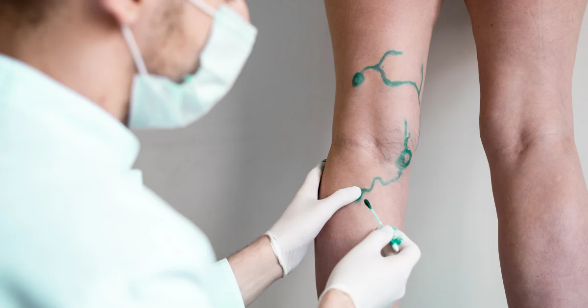 Le arterie hanno un’età biologica? Come cambia il sistema vascolare nel tempo e quando fare una valutazione