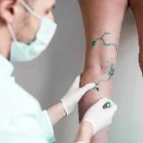 Chirurgia Vascolare