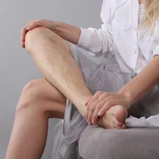 La cura delle vene e del microcircolo (Prestazioni angiologiche)