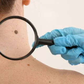 La cura della pelle (Prestazioni dermatologiche)