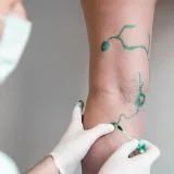 Chirurgia Vascolare